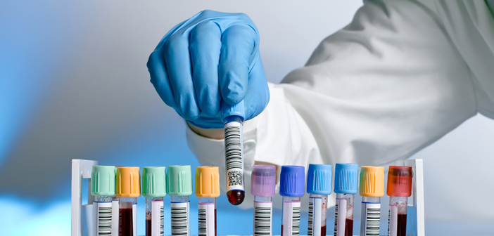 cityondemand-lab-test-deals-blood-test